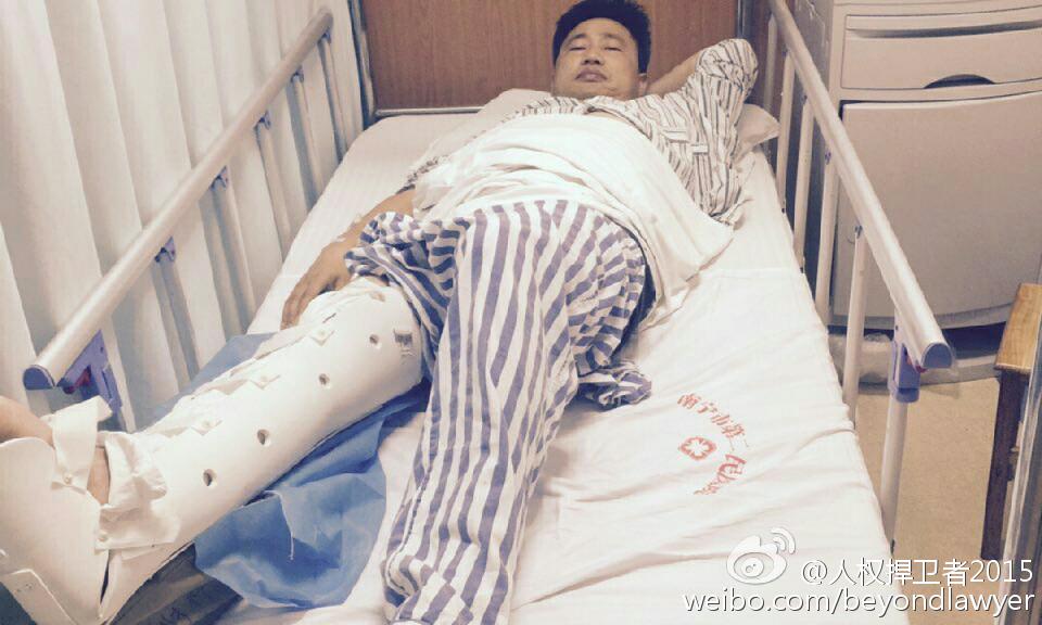 Unidentified men attacked lawyer Xie Yang (谢阳), leaving him with a fractured leg. Police did not respond to emergency calls for help during the assault.  